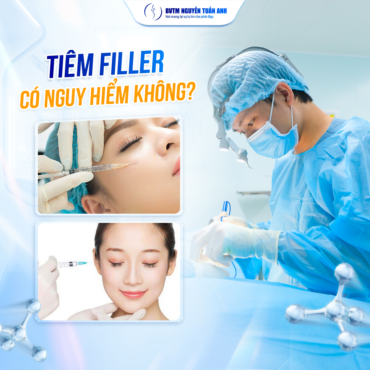 Tiêm Filler là gì và vì sao lại được ưa thích